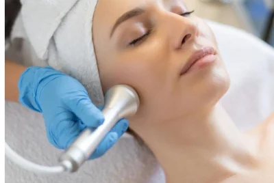 Microdermabrasion